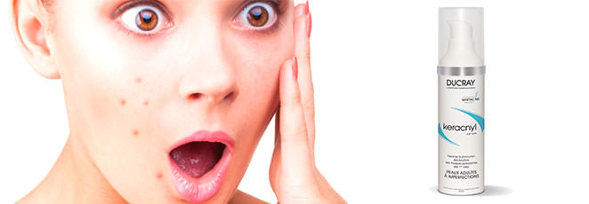 ¿Para piel acneica? Ducray Keracnyl Serum es la solución ¿Para piel acneica? Ducray Keracnyl Serum es la solución